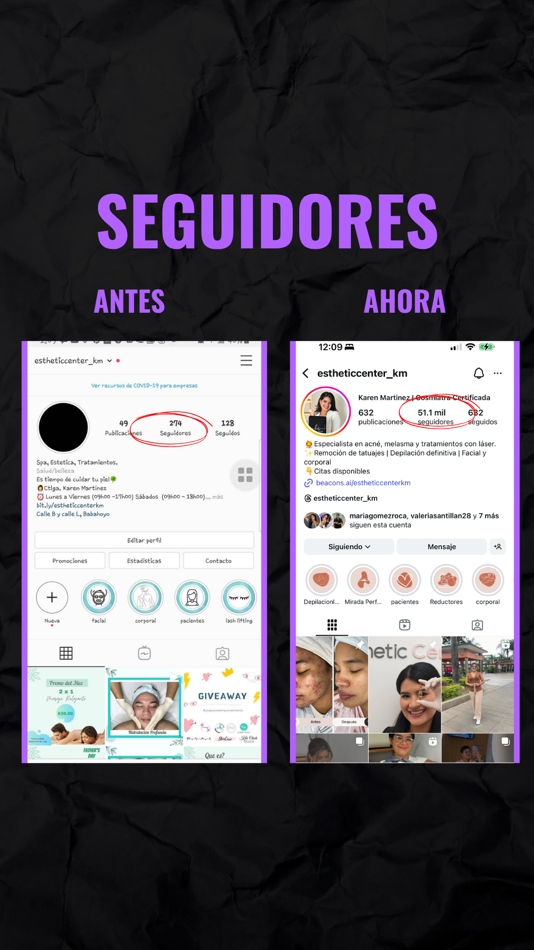 Seguidores antes/ahora